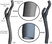 Fluid and solid finite element models of the internal carotid artery