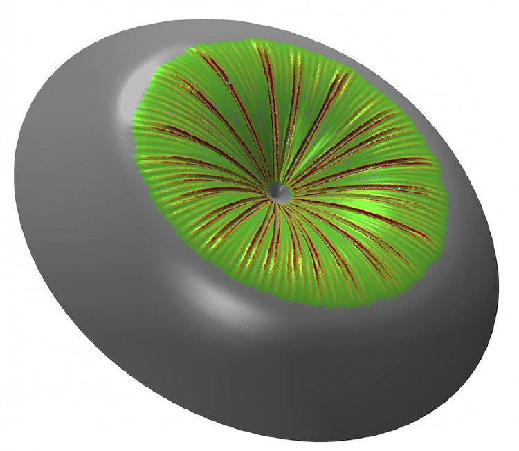 Wrinkling of spherical membrane with inward-directed point load