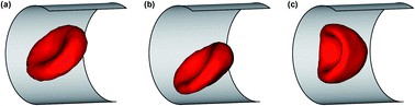 Deformation and dynamics of red blood cells in flow through cylindrical microchannels