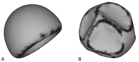 Crumpled spherical shells under external pressure or under control of volume change