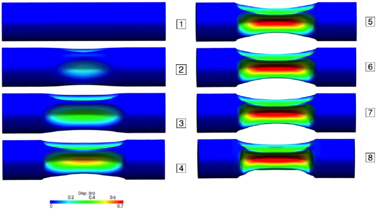 Fig. 16. Calculated set of deformed configurations for IMP69 with color contours representing the radial displacement.