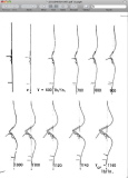 Axisymmetric pre-buckling deformation of the axially compressed rocket interstage shown on the previous slide