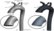 Fluid and solid finite element models of the left carotid artery